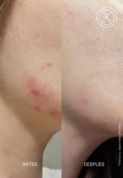 Acnemy Serum & Kur ·Serum|