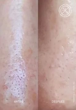 Acnemy Spezialpflege·Akne|