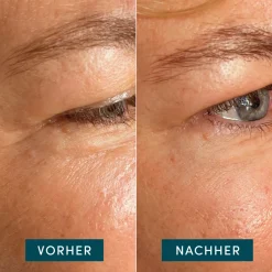 Apricot Augenpflege·Augenpflege|