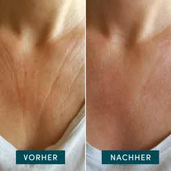 Apricot Gesichtpflege·Hals & Décolleté|