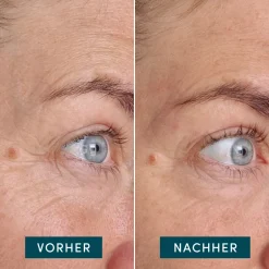 Apricot Augenpflege·Augenpflege|