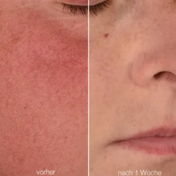 Dermalogica Anti Aging·Anti-Aging|