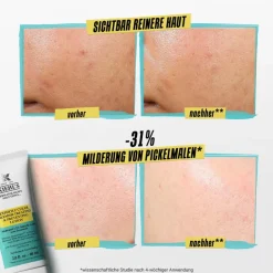 KIEHL'S Spezialpflege·Akne|