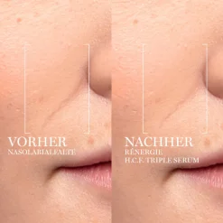 Lancôme Serum & Kur ·Serum|