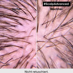 L'Oréal Professionnel Haarserum|