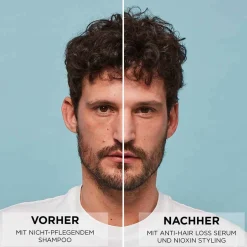 NIOXIN Haarserum|